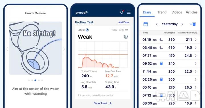[서울=뉴시스] proudP 앱 사용 화면. 소변을 볼 때 앱을 활용해 배뇨 검사(왼쪽)를 시행한다. 이후 배뇨 검사 결과(중간) 및 일시별 배뇨량과 최대 배뇨 속도(오른쪽)를 확인할 수 있다.(사진= 분당서울대병원 제공)