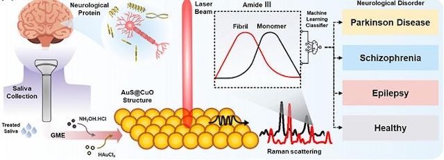 [서울=뉴시스] 침을 이용한 뇌신경질환 진단 개념도. (사진=고려대 제공) 2026.02.02. photo@newsis.com *재판매 및 DB 금지