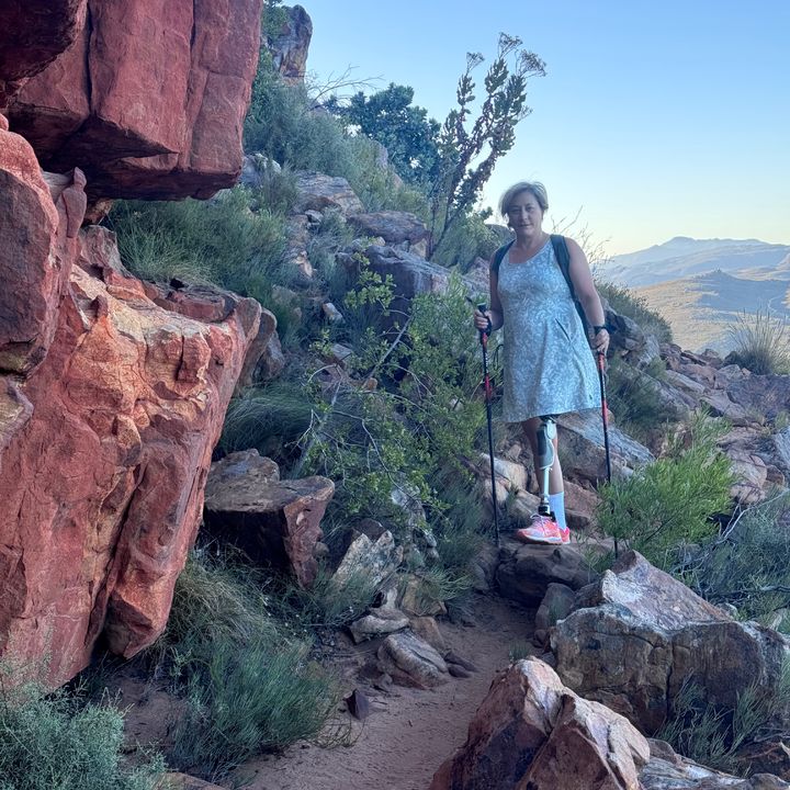 "단순 감기인 줄 알았는데"…'살 파먹는 병'으로 한쪽 다리 절단