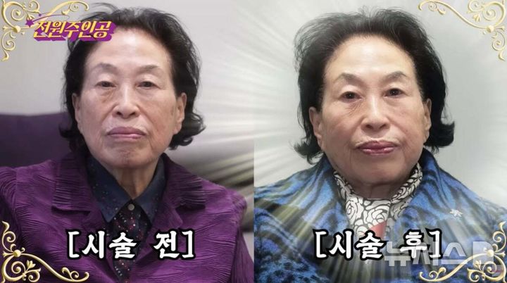 '짠돌이' 전원주, 500만원 피부과 시술…"주름 하나 없이 매끈"