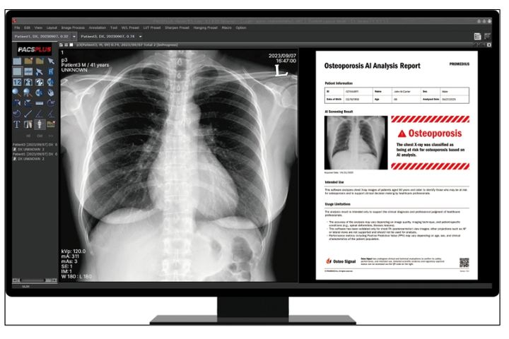 [서울-뉴시스] 5일 의료기기업계에 따르면 노을, 프로메디우스, 휴이노 등 국내 의료AI 업체들은 오는 9일부터 두바이에서 개최되는 글로벌 헬스케어 전시회 'WHX(World Health Expo) Labs 두바이 2026'에 참가한다. (사진=프로메디우스 제공) 2026.02.06. photo@newsis.com *재판매 및 DB 금지