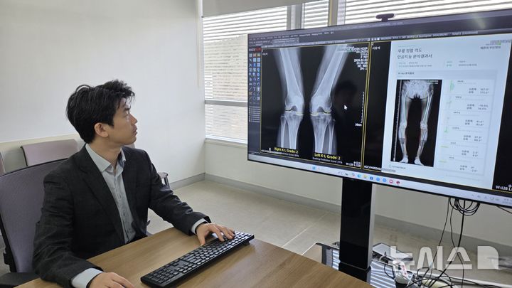 "엑스레이 한장으로"…AI가 10초만에 관절염 상태 판독[빠정예진]