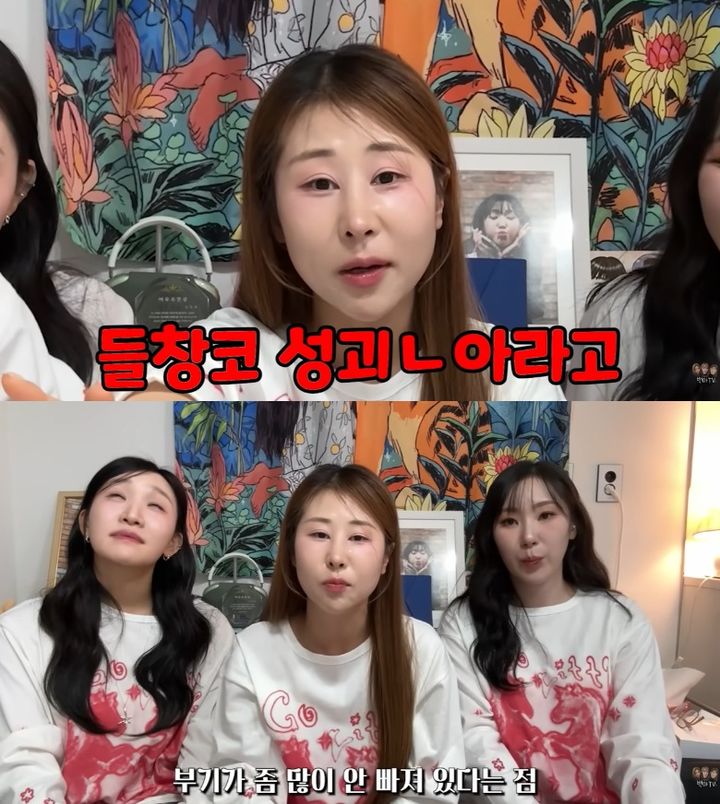 박세미 "들창코 성괴 DM에 코 재수술"