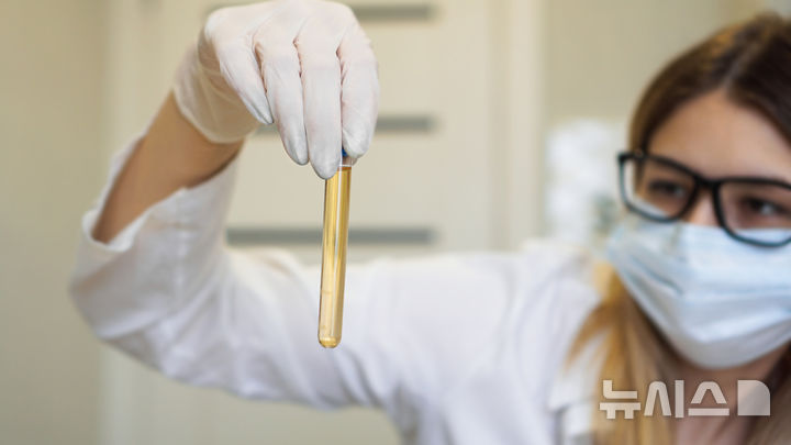 [서울=뉴시스] 단백뇨는 소변에 단백질이 섞여 나오는 상태로, 성인 기준 하루 배출량이 150㎎ 이상일 때 진단한다. (사진= 유토이미지 제공)