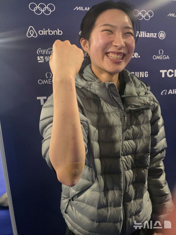 [밀라노=뉴시스] 김희준 기자 = 11일(현지 시간) 이탈리아 밀라노 아이스스케이팅 아레나에서 훈련을 마친 쇼트트랙 대표팀의 김길리가 웃으면서 충돌로 다친 부위를 보여주고 있다. 2026.02.11jinxijun@newsis.com