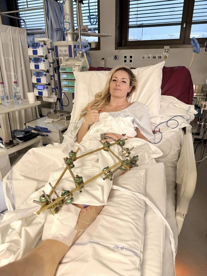 [서울=뉴시스] 지난 8일(한국 시간) 이탈리아 코르티나담페초의 토파네 알파인스키 센터에서 열린 2026 밀라노·코르티나담페초 동계올림픽 알파인 스키 여자 활강 경기 도중 부상을 당한 미국의 스키 여제 린지 본이 12일 자신의 사회관계망서비스(SNS)를 통해 성공적으로 수술을 마쳤다는 소식을 전했다. (사진=린지 본 SNS 캡처) 2026.02.12. *재판매 및 DB 금지