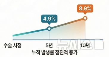 [서울=뉴시스] 전체 환자 중 중 치료가 필요한 담석 질환의 누적 발생률은 수술 후 5년 4.9%, 10년 8.9%로 시간이 경과할수록 담석 질환 위험이 높아지는 것으로 나타났다. (사진= 세브란스병원 제공) 