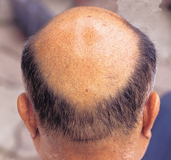 "냄새 때문에 정수리 드러나"…취두부 식당에 분노 폭발