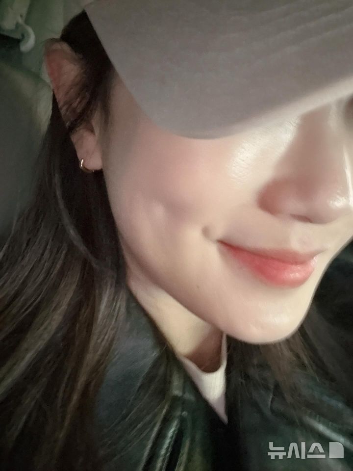 '김준호♥' 김지민, 2세 준비 중 낙상 사고…"얼굴로 넘어져"