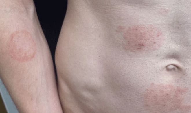 사진 미국 질병통제예방센터(CDC) *재판매 및 DB 금지