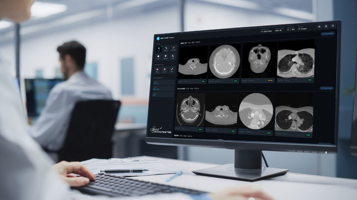 [서울=뉴시스] 멀티모달 데이터 플랫폼 전문기업 미소정보기술은 의료 이미지 데이터 부족 문제 해결을 위한 HQGAN(High-Quality Quantum GAN·HQGAN) 모델 개발 및 상용화 기술을 확보했다고 23일 밝혔다. (사진=미소정보기술 제공) 2026.02.23. photo@newsis.com *재판매 및 DB 금지