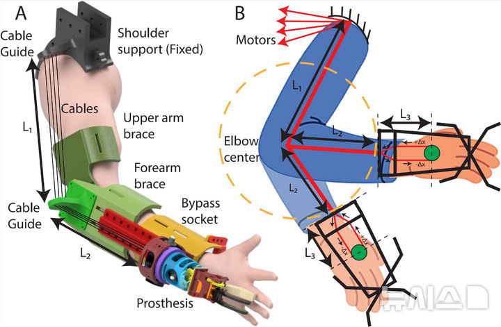 케이블 구동 기반 I-PEDLE 상지 의수 시스템의 구조 설계 및 전달 원리도. 상완·전완 브레이스와 케이블 구동 구조, 관절 움직임 전 구간에서 일정한 케이블 길이를 유지하는 전달 메커니즘을 나타낸다. (그래픽=GIST 제공) photo@newsis.com
