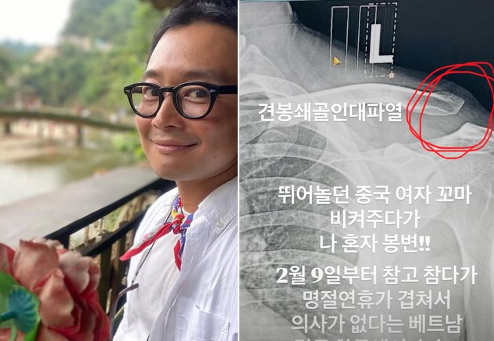 [서울=뉴시스] 배우 이켠이 베트남에서 어깨 부상을 입고 귀국해 수술을 받았다. (사진=인스타그램 캡처) 2026.02.25. photo@newsis.com *재판매 및 DB 금지