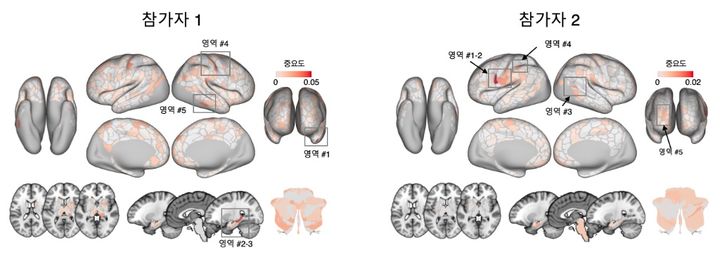 [서울=뉴시스] '뇌영상 기반 만성통증 마커'에서 환자마다 중요한 영역들이 상이함을 보여주는 결과. (사진=성균관대 제공) 2026.02.27. photo@newsis.com *재판매 및 DB 금지