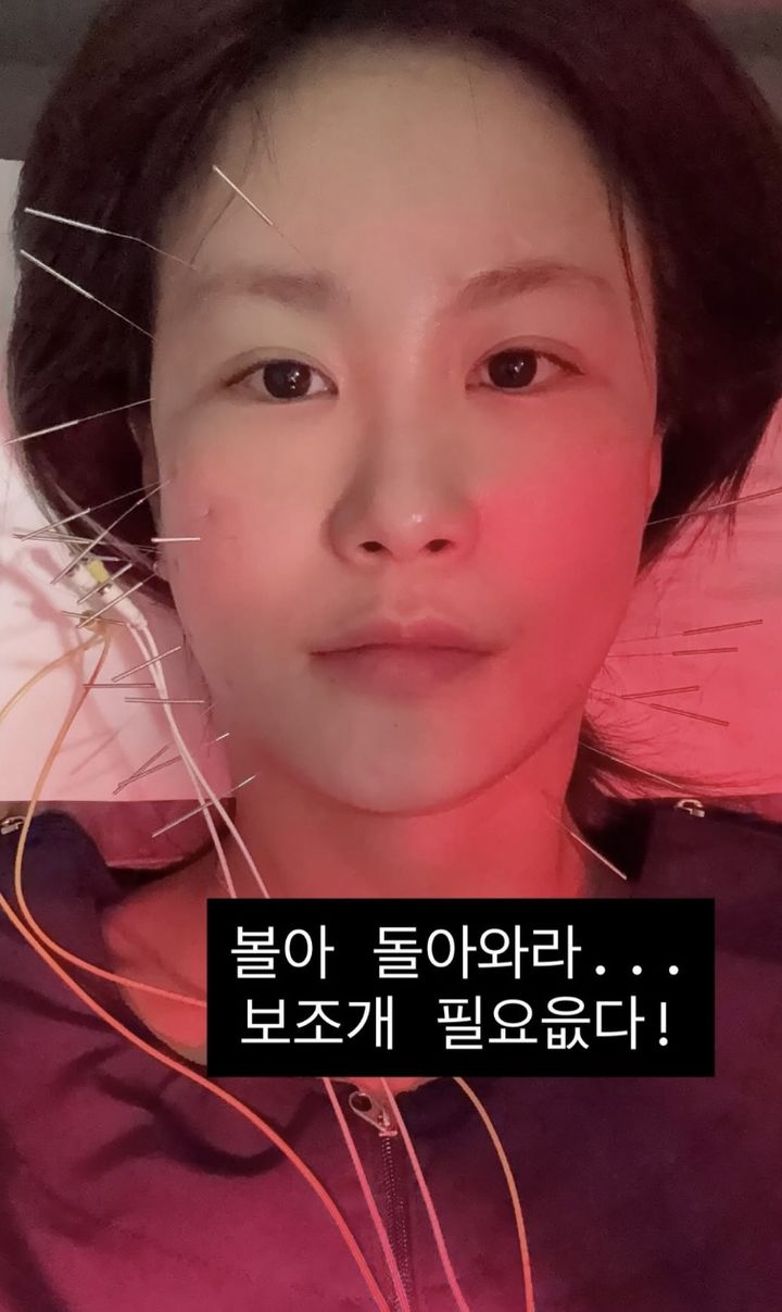 [서울=뉴시스] 코미디언 김지민이 낙상 사고 후 치료 중인 근황을 공개했다. (사진 = 김지민 인스타그램 캡처) 2026.03.01. photo@newsis *재판매 및 DB 금지