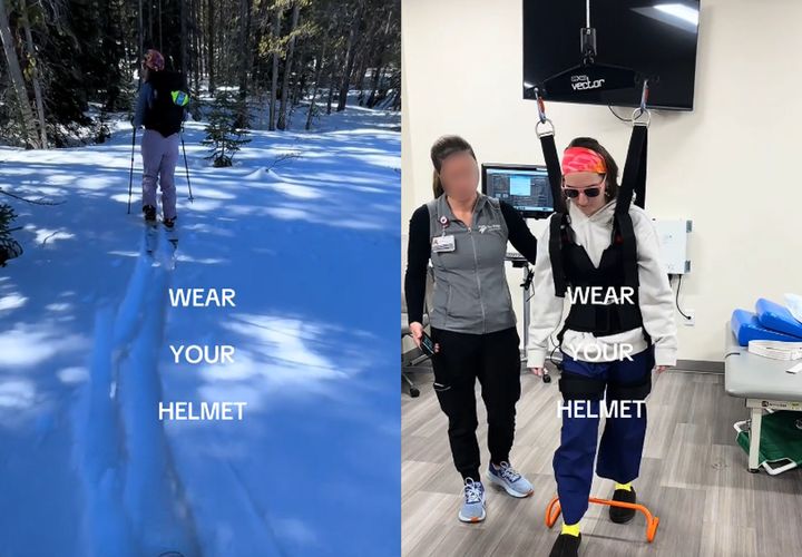 [뉴시스] 최근 스키를 타다 사고를 당한 미국의 한 여성이 헬멧 착용의 중요성을 강조했다. (사진=틱톡 갈무리) *재판매 및 DB 금지