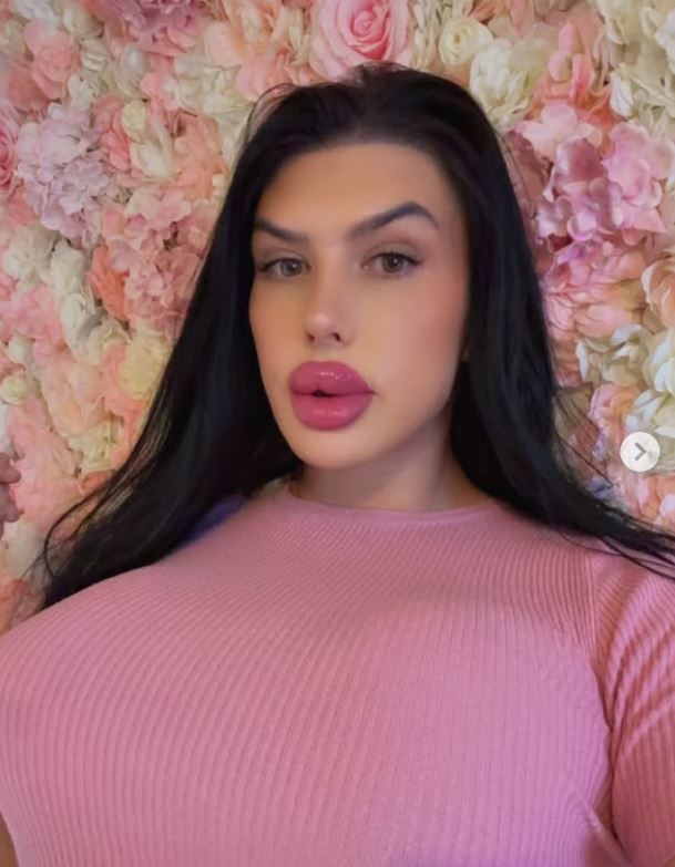 [뉴시스] '영국에서 가장 큰 입술'을 가진 것으로 알려진 모델이 10년 만에 얼굴 필러를 모두 제거하고 본래의 얼굴을 공개해 화제다. (사진=인스타그램) *재판매 및 DB 금지