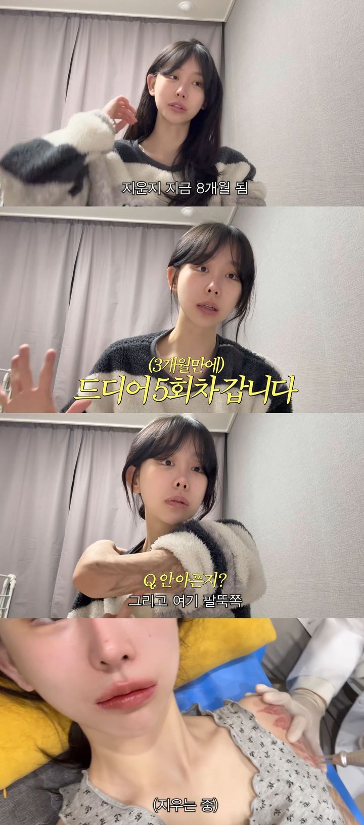 [서울=뉴시스] 유튜버 조두팔이 지난 9일 유튜브 채널에 올린 영상에서 문신 제거한 팔을 공개했다. (사진=유튜브 채널 '조두팔' 캡처) 2026.03.10. photo@newsis.com *재판매 및 DB 금지