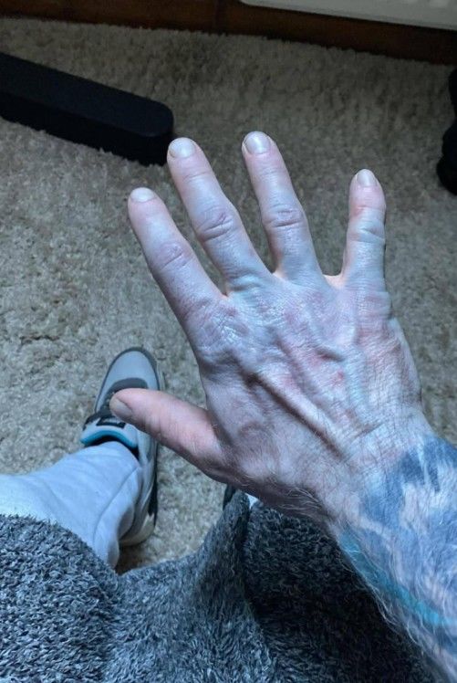 [뉴시스]영국 더비셔주의 한 남성이 잠에서 깬 뒤 몸이 파랗게 변해 급하게 병원을 찾았지만, 알고 보니 새 침대 시트의 염료가 몸에 물든 것으로 밝혀져 웃음을 자아냈다. (사진 = 페이스북 캡처) *재판매 및 DB 금지