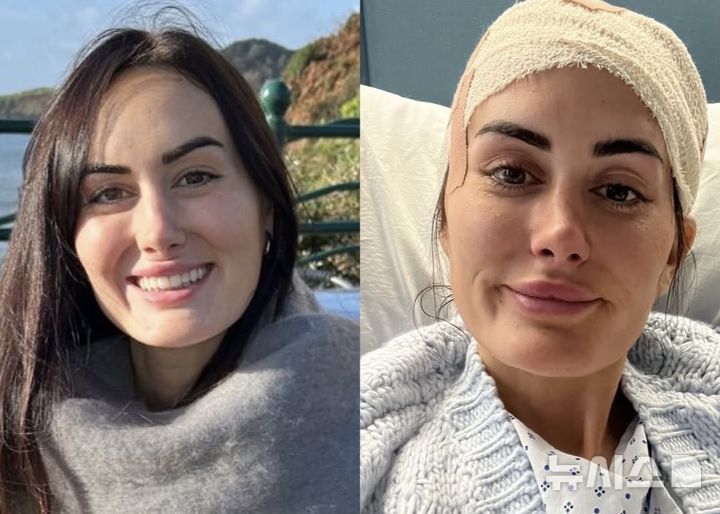 [뉴시스] (사진=영국 뇌종양 연구 단체 'Brain Tumour Research' 인스타그램 캡처. 해당 사연의 주인공인 로렌 맥퍼슨) 2026.03.15. *재판매 및 DB 금지