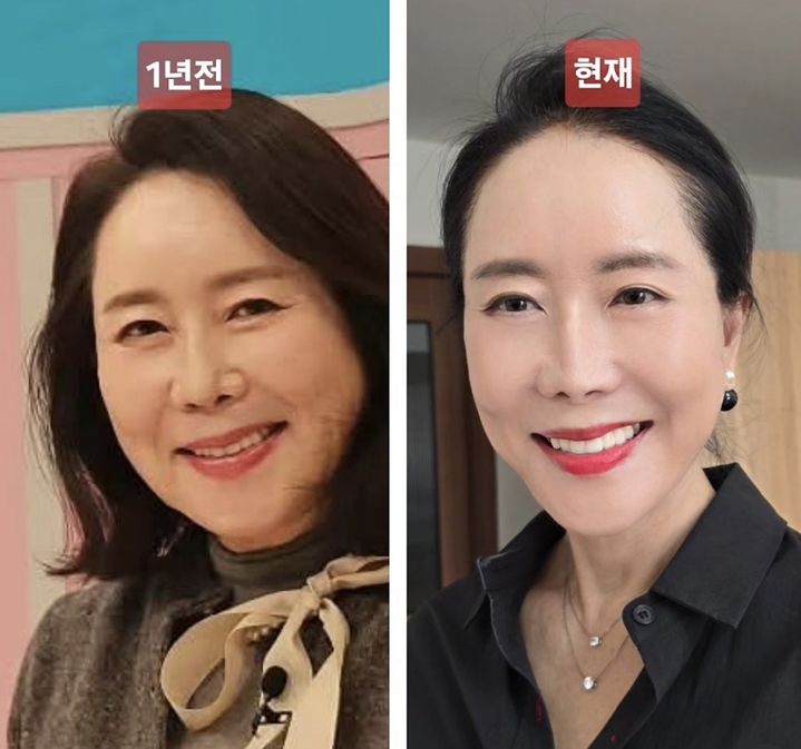 [뉴시스] 아나운서 출신 방송인 윤영미(64)가 안면거상술과 다이어트를 통해 달라진 모습을 공개했다. (사진=윤영미 인스타그램 캡처) *재판매 및 DB 금지