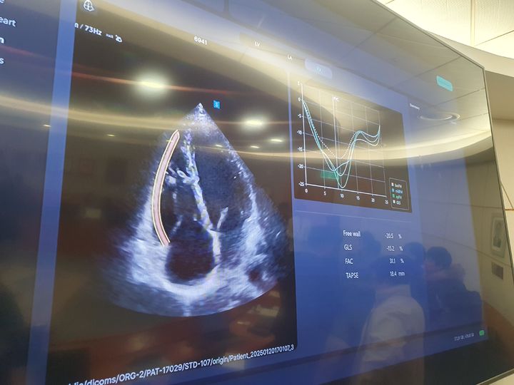 [성남=뉴시스] 구무서 기자 = 인공지능(AI)을 활용해 심장초음파 사진을 판독·측정하는 모습 2026.03.18. nowest@newsis.com *재판매 및 DB 금지