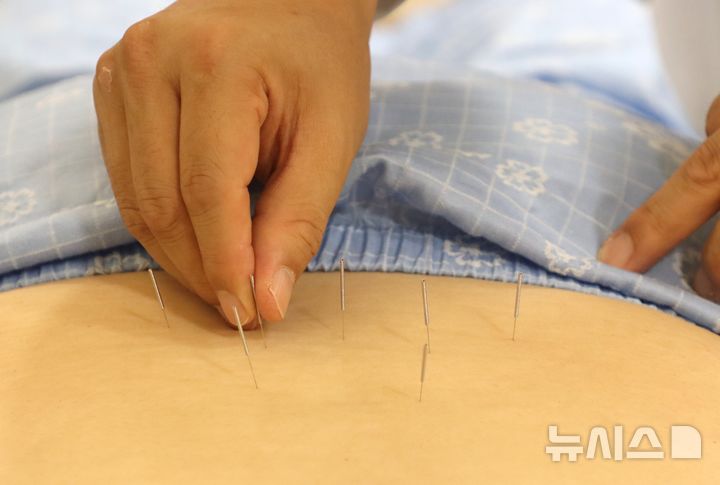 [서울=뉴시스] 자생한방병원 의료진이 허리 통증을 호소하는 환자에게 침 치료를 실시하고 있다. (사진= 자생한방병원 제공).