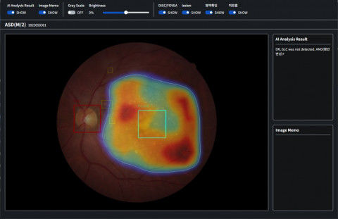 [서울=뉴시스] 의료 인공지능(AI) 기업 아크가 자이메드와 손잡고 만성질환 합병증 조기 발견을 위한 협력을 추진한다. (사진=아크 제공) 2026.03.19. photo@newsis.com *재판매 및 DB 금지