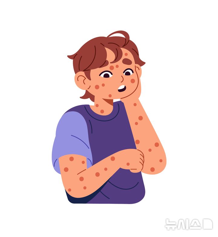 [서울=뉴시스] 수두는 보통 발열, 피로감, 식욕 감소 등의 증상으로 시작하며 이후 피부에 발진이 나타난다. (사진= 유토이미지 제공)