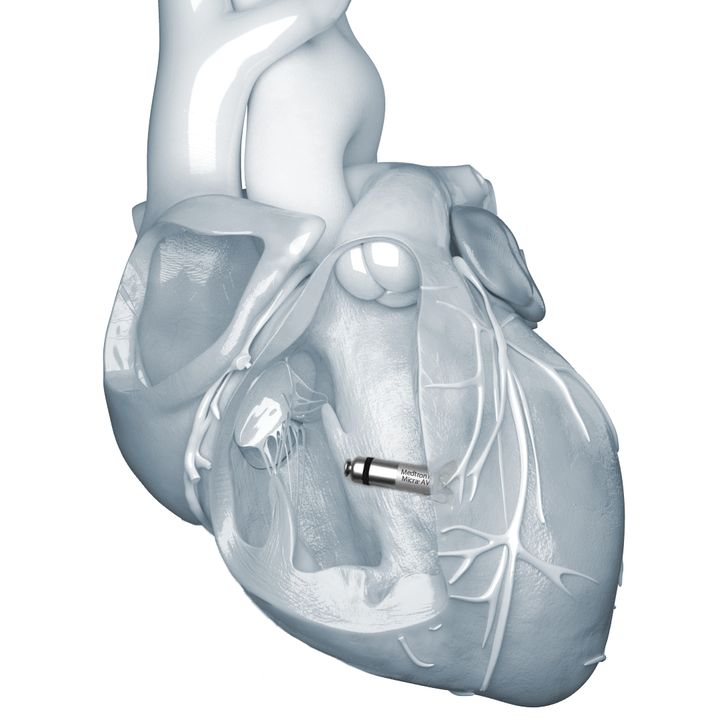 [서울=뉴시스] 25일 메드트로닉은 전력 소모 최적화와 배터리 구성 개선을 통해 기기 수명을 기존 대비 약 40% 향상한 마이크라2를 내달 국내 출시한다고 밝혔다. (사진=메드트로닉코리아 제공) 2026.03.25. photo@newsis.com *재판매 및 DB 금지