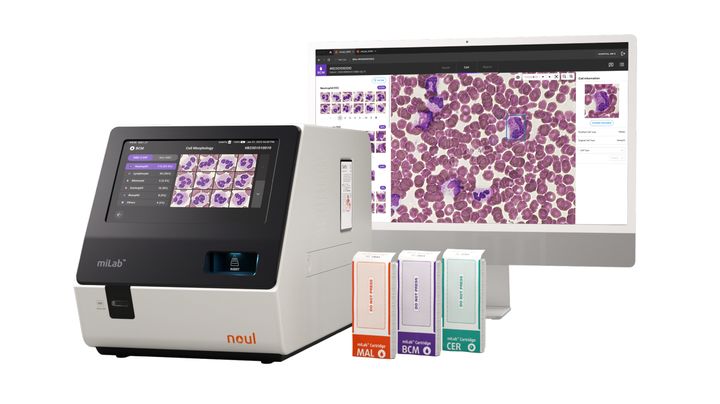 [서울=뉴시스] 인공지능(AI) 기반 혈액 및 암 진단 전문기업 노을은 해외 의료기기 전문 유통업체와 캐리비안 시장을 대상으로 공급 시장을 공급하는 계약을 체결했다고 30일 밝혔다. (사진=노을 제공) 2026.03.30. photo@newsis.com *재판매 및 DB 금지
