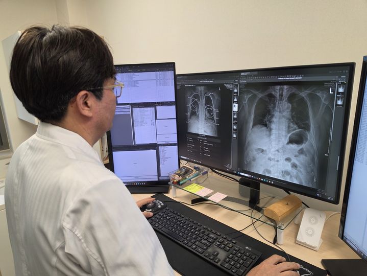 [울산소식]울산병원, 최첨단 AI 흉부엑스레이 분석 시스템 도입 등