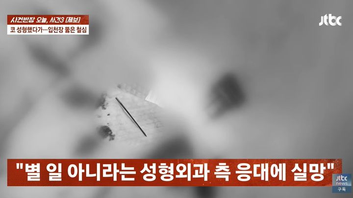 [서울=뉴시스]A씨 입천장을 뚫고 나온 철심. (사진출처: JTBC 사건반장) 2026.04.02.