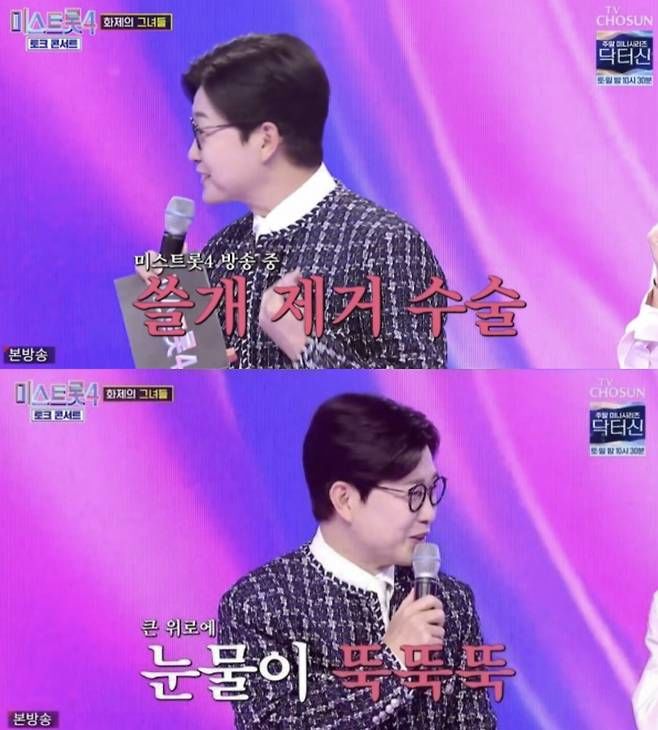 김성주 "미스트롯4 경연 중 쓸개 떼는 수술…눈물 났다"