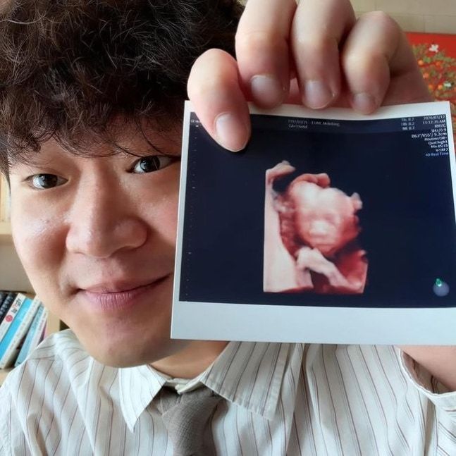 피식대학 정재형 아빠 된다 "너무 좋지만 너무 어려워"