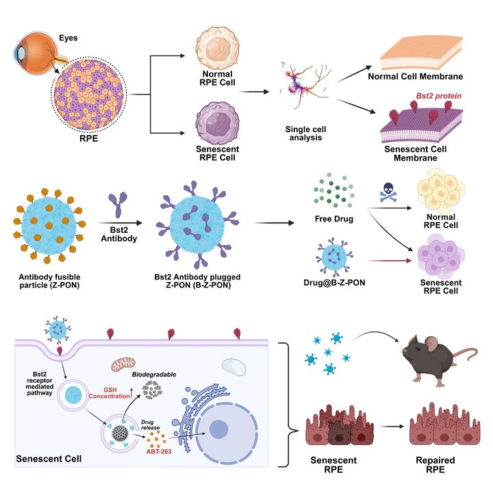 [울산=뉴시스] 노화된 망막색소상피세포만을 타켓으로 셀놀리틱 약물을 전달하는 나노 입자 (사진=UNIST 제공) 2026.04.08. photo@newsis.com *재판매 및 DB 금지