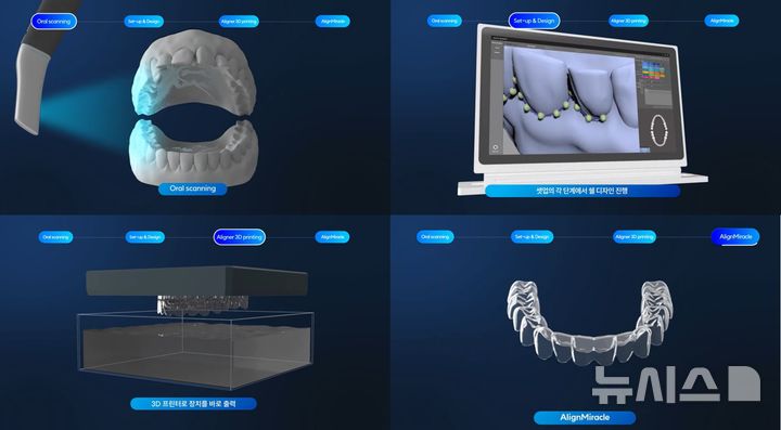 [서울=뉴시스] 얼라인미라클(Align Miracle) 투명교정 장치 제작 과정. (사진= 중앙대학교광명병원 제공)