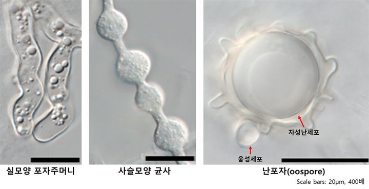 [세종=뉴시스] 난균류 신종 Pythium aculeatus 형태. (사진=국립낙동강생물자원관 제공) 2026.04.14. photo@newsis.com *재판매 및 DB 금지