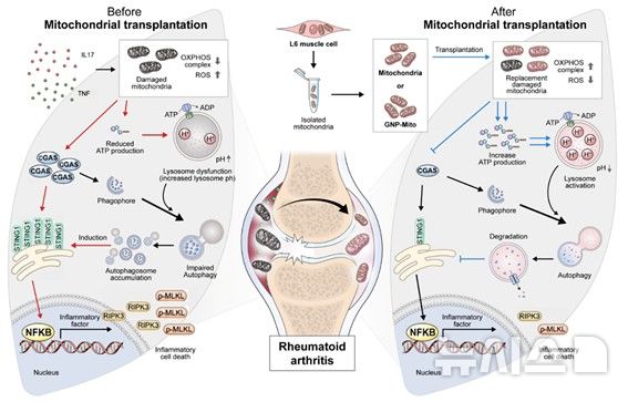 [서울=뉴시스] 류마티스관절염 활막세포 내 미토콘드리아 이식으로 자가포식 및 CGAS-STING1 기전 조절 효과 확인. (사진= 가톨릭중앙의료원 제공)