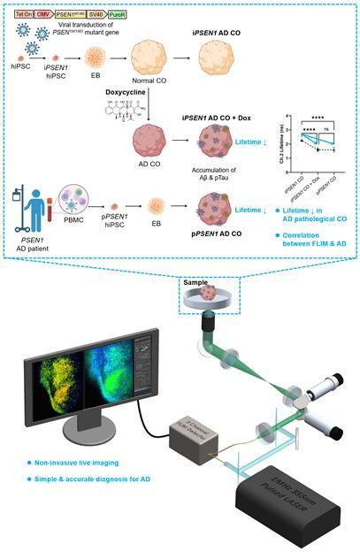 [서울=뉴시스] 알츠하이머병 뇌 오가노이드 모델과 FLIM 분석 플랫폼의 개요도. (사진=고려대 제공) 2026.04.20. photo@newsis.com *재판매 및 DB 금지