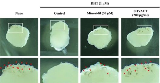 [서울=뉴시스] 모발 오가노이드 기반 탈모 재현 및 치료 효과 분석 이미지. (사진=오가노이드사이언스 제공) 2026.4.21. photo@newsis.com *재판매 및 DB 금지