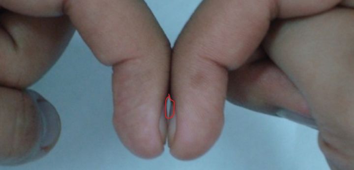 사진 로이캐슬폐암재단 홈페이지 캡처 *재판매 및 DB 금지