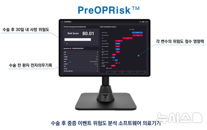 [서울=뉴시스] PreOPRisk 설명 이미지. (사진= 서울아산병원 제공)