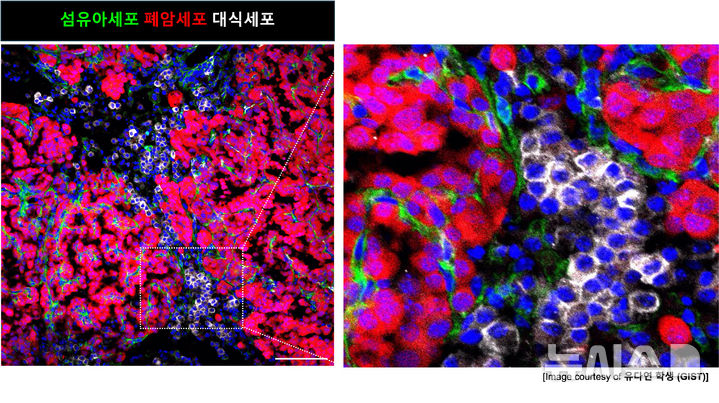 초기 폐암에서 돌연변이 줄기세포가 주변 환경을 바꾸는 과정도. (그래픽=GIST 제공) photo@newsis.com