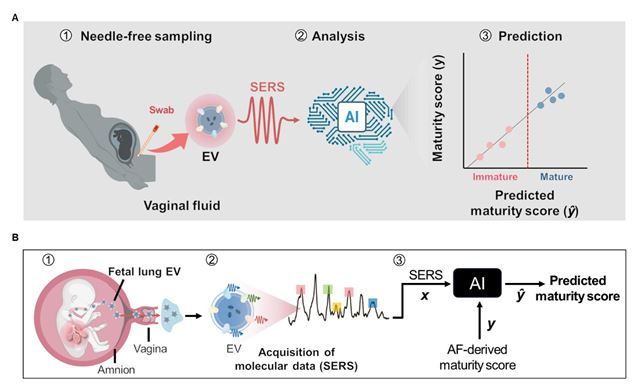[서울=뉴시스] 고려대·분당서울대병원 연구진이 개발한 '태아 폐 성숙도 AI 진단 플랫폼'의 개념 및 분석 흐름도. (사진=고려대 제공) 2026.04.30. photo@newsis.com *재판매 및 DB 금지