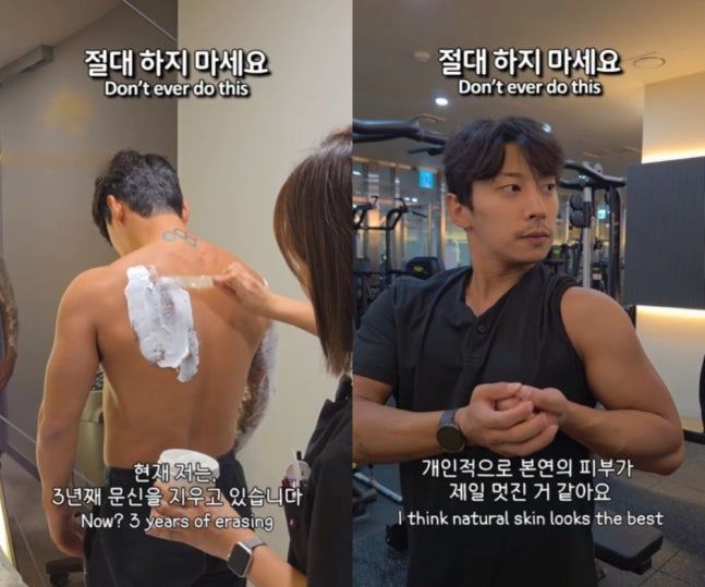 3년째 문신 제거 시술 곽윤기 "절대, 절대 하지 마세요"