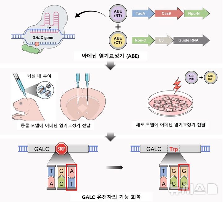 [서울=뉴시스] 뇌와 신경을 보호하는 수초가 망가지는 희귀 유전질환 크라베병을 유전자 편집으로 치료할 수 있다는 연구 결과가 나왔다. (사진= 세브란스병원 제공)