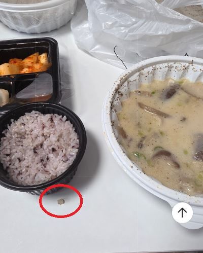 [서울=뉴시스]국밥을 먹다 치아가 부러졌다고 주장한 고객이 공개한 부러진 치아 사진.(사진출처: 아프니까사장이다 캡처) 2026.05.18.