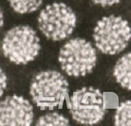 [서울=뉴시스] 인유두종바이러스. (사진= 서울아산병원 제공)