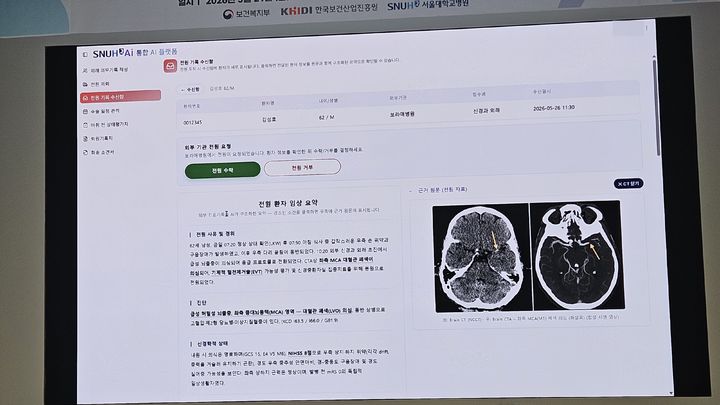 [서울=뉴시스]강진아 기자=보건복지부가 지난 29일 서울 종로구 서울대병원에서 '환자 의뢰·회송 AX'에 대한 정책간담회 및 기술 시연회를 진행했다. 서울대병원이 자체 개발한 의료 AI 플랫폼 '스누하이'를 통해 시연한 환자 전원 절차 시스템. 2026.05.31. akang@newsis.com *재판매 및 DB 금지